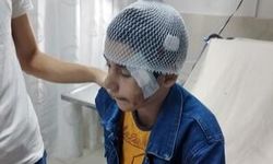 Yüzüne yorgun mermi isabet etti