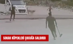 Sokak köpekleri çocuğa saldırdı