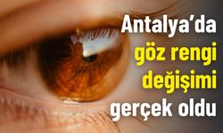 Antalya’da göz rengi değişimi gerçek oldu
