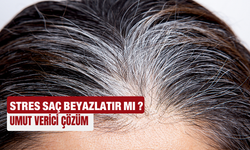 Stres saç beyazlatır mı? Bilimsel gerçek ortaya çıktı!