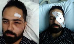 15 Temmuz Gazisi Akkoç: "Darbeci asker dalga geçer bir ses tonu ile ‘sen kelime-i şehadet getir’ dedi"