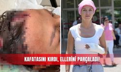 Kafatasını kırdı, ellerini parçaladı!