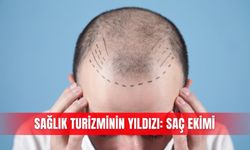 Sağlık turizminin yıldızı: Saç ekimi