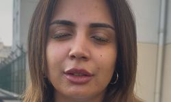 Güzellik merkezinde genç kadının gözüne yapıştırıcı kaçtı: "Kör olabilirdim"