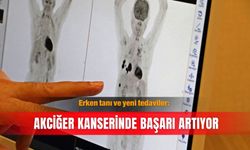 Erken tanı ve yeni tedaviler: Akciğer kanserinde başarı artıyor