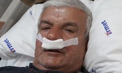 65 yaşındaki adamın burnundan 100 gramlık taş çıkarıldı