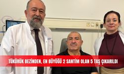 Tükürük bezinden, en büyüğü 2 santim olan 5 taş çıkarıldı