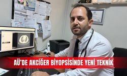 AÜ’de akciğer biyopsisinde yeni teknik