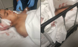 Ankara’da başıboş köpek dehşeti!