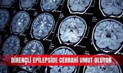 Dirençli epilepside cerrahi umut oluyor