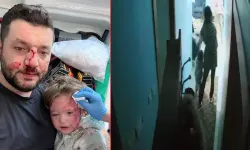 Baba ile 14 aylık bebeğinin darbedildiği olayda şüphelilerin ifadesi ortaya çıktı