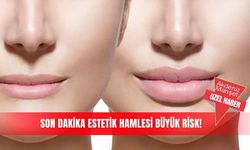 Son dakika estetik hamlesi büyük risk!