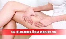 Yaz sıcaklarında ödem kabusuna son