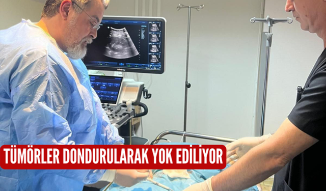 Tümörler dondurularak yok ediliyor