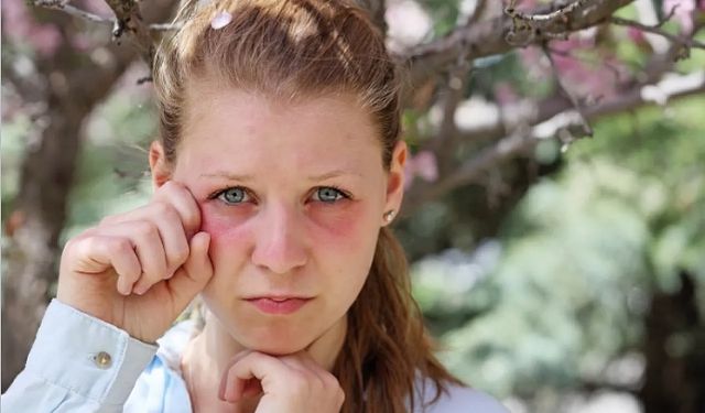‘İlkbahar ve yaz aylarında göz alerjisi görülme oranı artıyor’