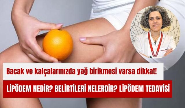 Lipödem nedir? Belirtileri nelerdir? Lipödem tedavisi
