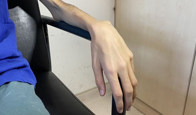 Ergenlerde anoreksiya tehlikesi