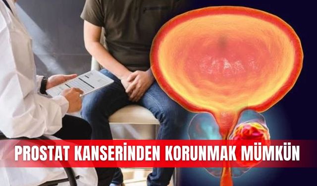 Prostat kanserinden korunmak mümkün