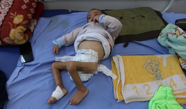 Gazzeli çocuklar ateşkesin gölgesinde açlıkla savaşıyor