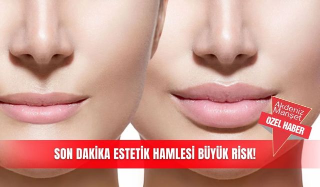 Son dakika estetik hamlesi büyük risk!