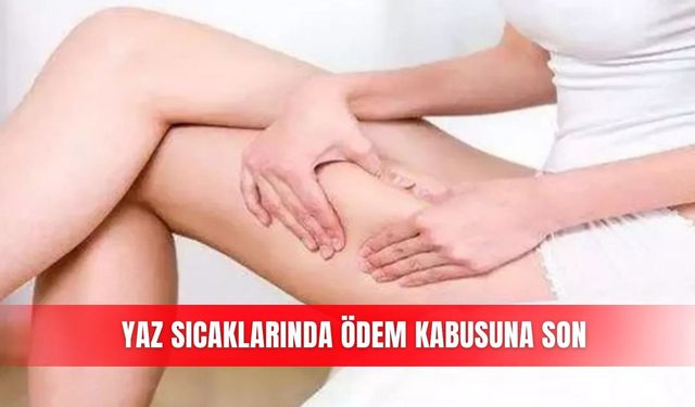 Yaz sıcaklarında ödem kabusuna son