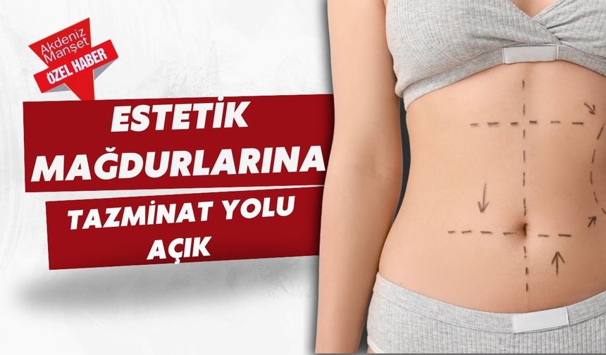 Estetik mağdurlarına tazminat yolu açık
