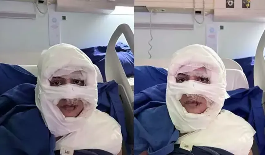 Kadıköy’de korkunç saldırı: Üzerine yanıcı madde dökülen kadın alevler içinde kaldı