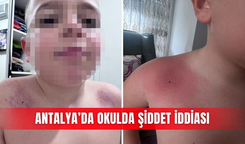 Antalya’da okulda şiddet iddiası