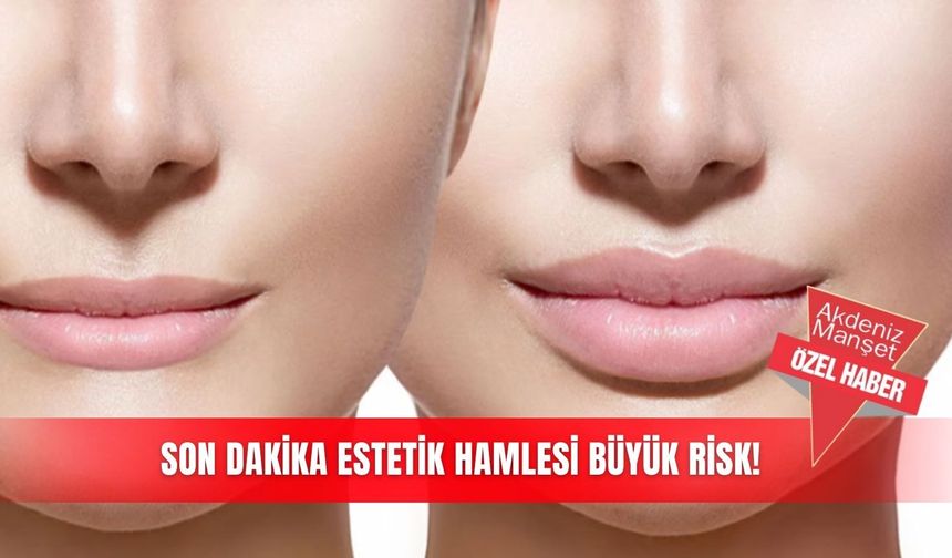 Son dakika estetik hamlesi büyük risk!