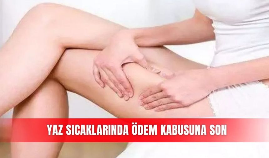 Yaz sıcaklarında ödem kabusuna son