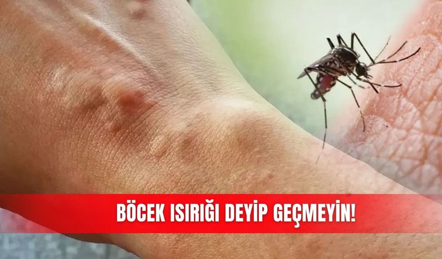 Böcek ısırığı deyip geçmeyin!