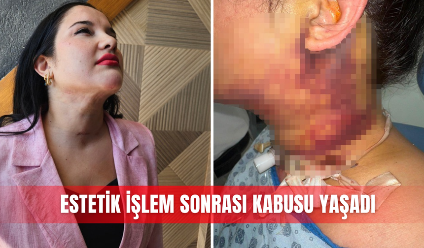 Estetik işlem sonrası kabusu yaşadı