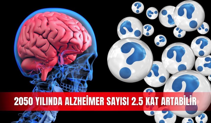 2050 yılında Alzheimer sayısı 2.5 kat artabilir